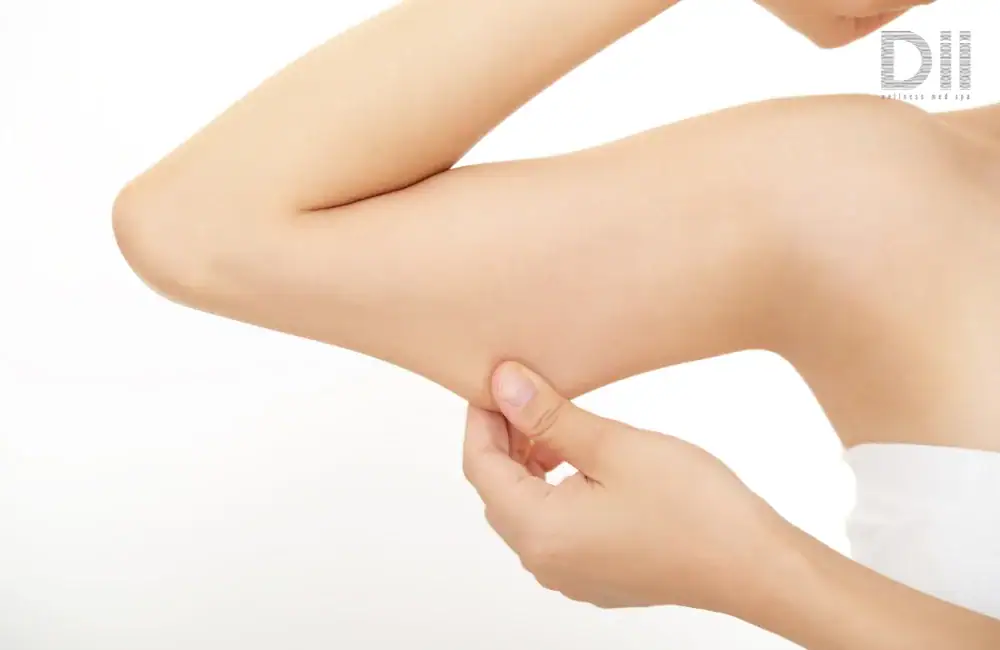 ลดแขนใหญ่ ที่ Dii Wellness Clinic